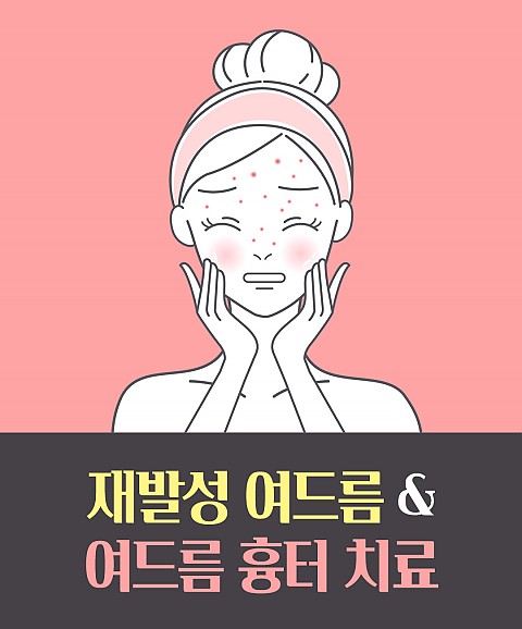 [한스경제] 성신여대피부과 재발성 여드름과 여드름 흉터 개선 